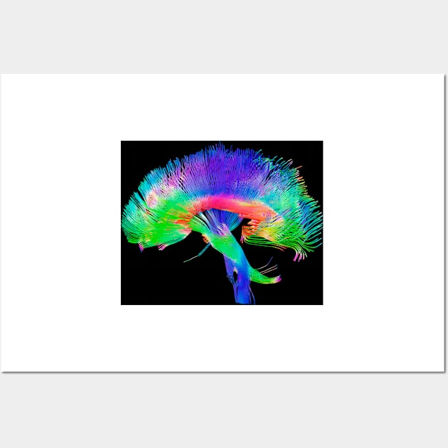 Brain pathways (P335/0069) Wall Art by SciencePhoto